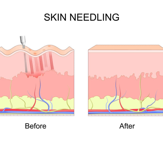 Wireless Microneedling Derma Pen/Mas Pen L3 Skin Care Tool